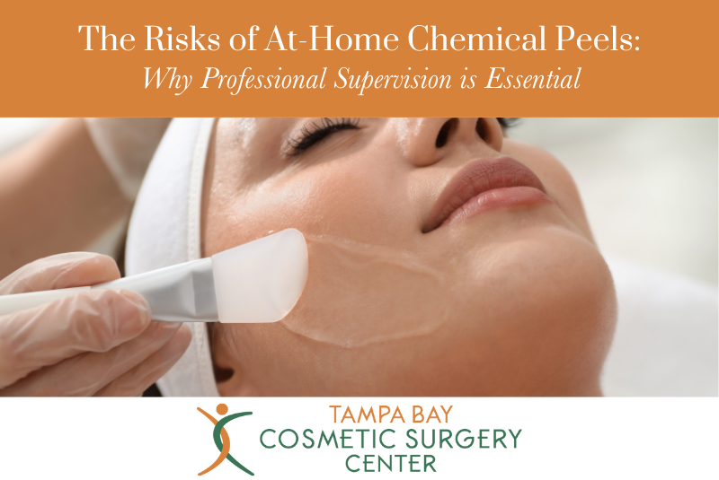 The Risks of At-Home Chemical Peels Why Professional Supervision is Essential