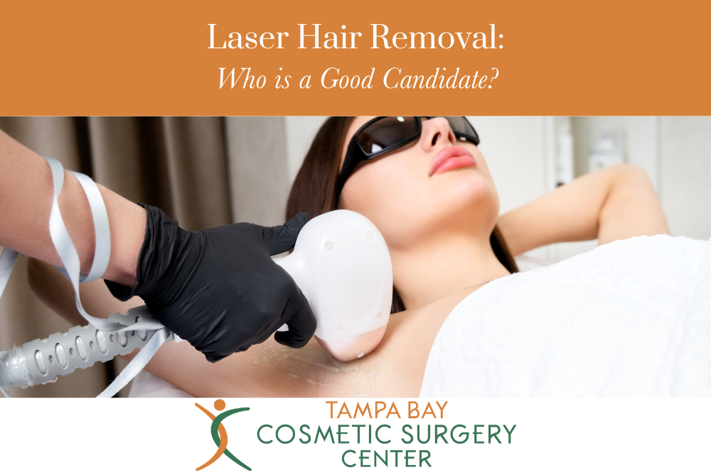 Laser Hair Removal Who is a Good Candidate