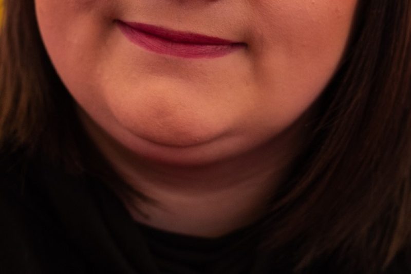 What Can Be Done To Correct A Double Chin? Surgical Vs. Non-Surgical